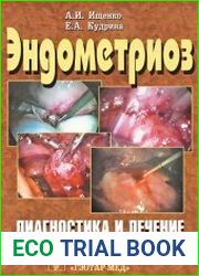 Эндометриоз. Диагностика и лечение