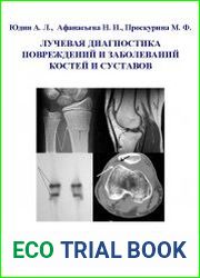 Лучевая диагностика повреждений и заболеваний костей и суставов
