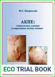 Акне этиопатогенез, клиника и современные методы лечения