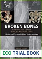 Broken Bones The Radiologic Atlas of Fractures and Dislocations