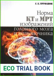 Норма КТ и МРТ изображений головного мозга и позвоночника