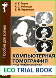Компьютерная томография при туберкулезе органов дыхания