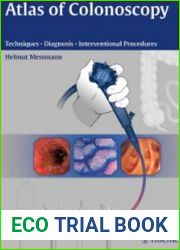 Atlas of Colonoscopy Techniques, Diagnosis, Interventional Procedures