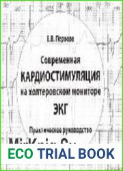 Современная кардиостимуляция на холтеровском мониторе ЭКГ