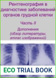 Рентгенография в диагностике заболеваний органов грудной клетки. Часть II
