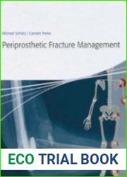 Periprosthetic Fracture Management