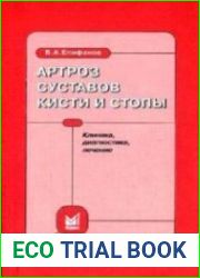 Артроз суставов кисти и стопы. Клиника, диагностика, лечение