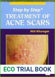 Step by Step Treatment of Acne Scars