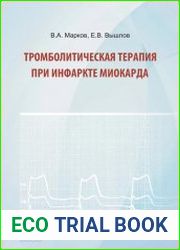Тромболитическая терапия при инфаркте миокарда