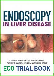 Endoscopy in Liver Disease