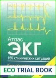 Атлас ЭКГ. 150 клинических ситуаций