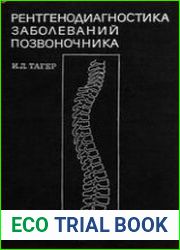 Рентгенодиагностика заболеваний позвоночника
