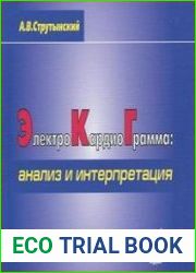 Электрокардиограмма анализ и интерпретация