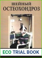 Шейный остеохондроз