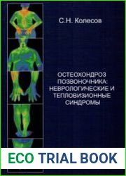 Остеохондроз позвоночника неврологические и тепловизионные синдромы