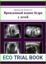 Врожденный вывих бедра у детей