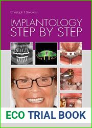 Implantology Step by Step