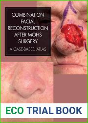 Combination Facial Reconstruction after Mohs Surgery: A Case Based Atlas