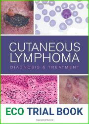 Cutaneous Lymphoma: Diagnosis and Treatment