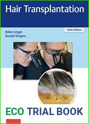 Hair Transplantation