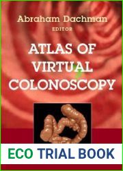 Atlas of Virtual Colonoscopy