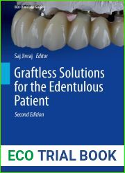Graftless Solutions for the Edentulous Patient (BDJ Clinician|s Guides)