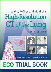 Webb, Muller and Naidich|s High-Resolution CT of the Lung