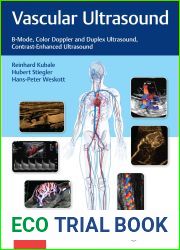 Vascular Ultrasound: B-Mode, Color Doppler and Duplex Ultrasound, Contrast-Enhanced Ultrasound