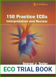 150 Practice ECGs: Interpretation and Review
